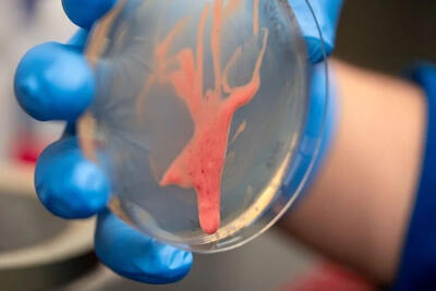 کشف راز یک قاتل نامرئی