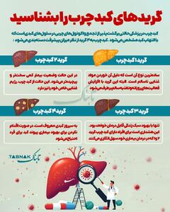 اینفوتابناک | گریدهای کبد چرب را بشناسید