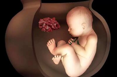 دو جنین ۶۵۰۰ ساله در تپه چپرآباد ایران کشف شد