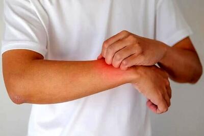 به این دلیل مهم نگران گزگز دست تان باشید