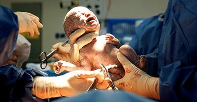 پیشرفت‌های ایران در علم پزشکی در حوزه زنان