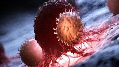 چرایی افزایش بروز سرطان‌ها / شایع‌ترین سرطان‌ها در ایران