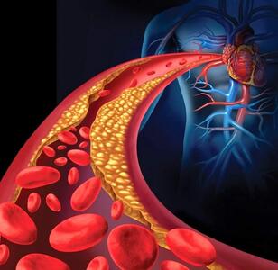 اگر این علائم را دارید فوراً به پزشک مراجعه کنید! / ۷ نشانه لخته شدن خون