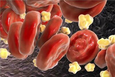 متخصص قلب: کلسترول بالا از جوانی آغاز می‌شود