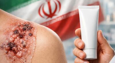  با یک پماد ایرانی، سرطان پوست درمان شد