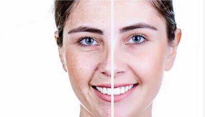  برای مقابله با پیری پوست، این ۴ خوراکی را حتما بخورید!