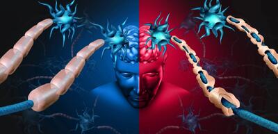  آیا ام‌اس تنها یک بیماری است؟