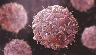  هر ۵ دقیقه یک ایرانی به سرطان مبتلا می‌شود!