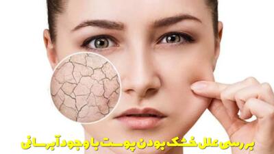  بررسی علل خشک بودن پوست با وجود آبرسانی + راهکار های خانگی و موثر