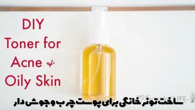  نحوه ساخت تونر خانگی برای پوست چرب و جوش دار با منافذ باز