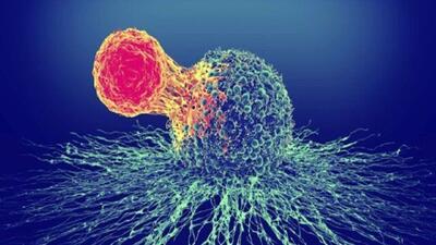  درمان سرطان بدون عوارض جانبی با روشی جدید  