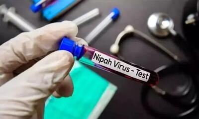  چقدر نگران ویروس نیپا باشیم؟ | آخرین وضعیت طغیان‌ در ۲۰۲۶