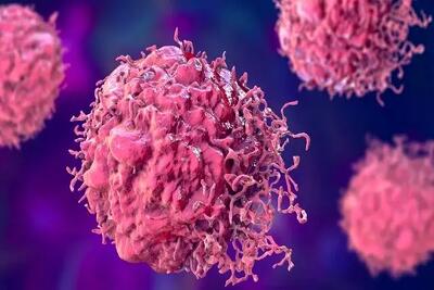  احتمال ۲۰ درصدی ابتلا به سرطان برای هر فرد