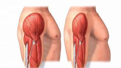  میگنا - آغاز تحلیل عضلانی از ۳۰ سالگی/ نسخه‌ای برای حفظ عضلات بدن