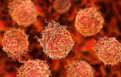  این بیماری دومین علت مرگ در ایران است