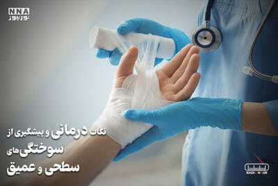  پادکست | نکات درمانی و پیشگیری از سوختگی های سطحی و عمیق