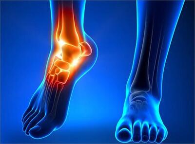  شروع تحلیل عضلانی از ۳۰ سالگی | نسخه‌ای برای حفظ عضلات بدن