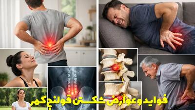  فواید و عوارض شکستن قولنج کمر + نحوه شکستن قولنج کمر به تنهایی