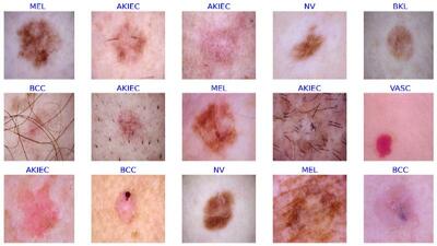  نشانه‌های پوستی که از بیماری خبر می‌دهند