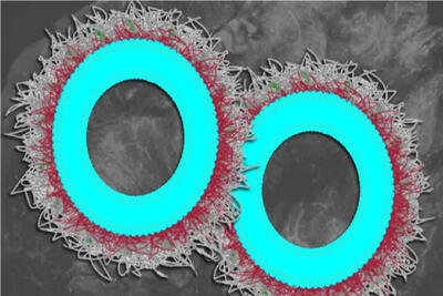  نانوذراتی که به جنگ پروتئین‌های مرگ‌آور می‌روند