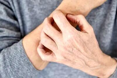  پوست شما چه بیماری‌هایی را لو می‌دهد