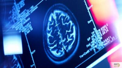  برای سلامت مغزتان، دور این چربی ها را خط قرمز بکشید