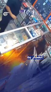  لحظه انفجار باتری لیتیومی در صورت یک نوجوان