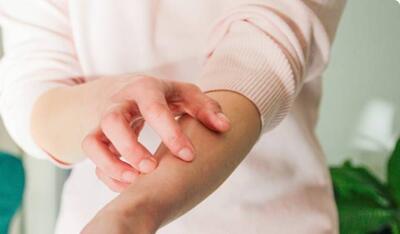  بهترین دارو برای خارش بدن خانگی