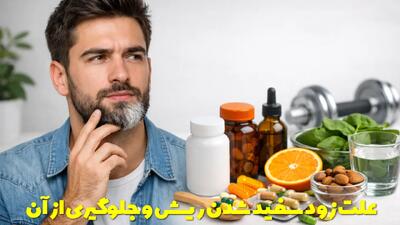  علت زود سفید شدن ریش در جوانی + قرص و روش های جلوگیری از سفید شدن ریش