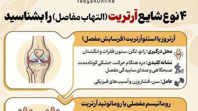  ۴ نوع شایع آرتریت را بشناسید
