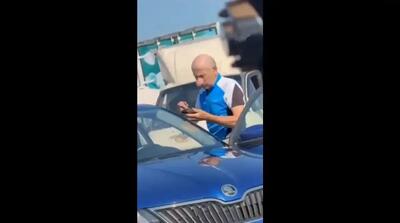  بینی بزرگ یک شهروند روس سوژه شبکه‌های اجتماعی شد