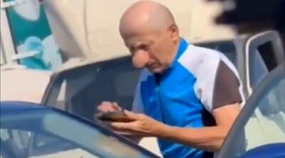  «سوپر بینی» یک روس سوژه جهانی شد!