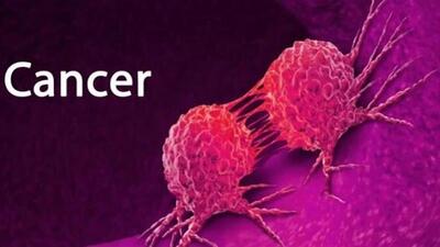  ۳۰ تا ۵۰ درصد سرطان‌ها قابل پیشگیری است / مردم به پیشگیری توجه کنند