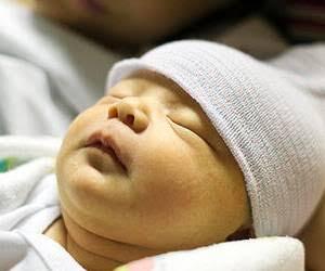  زردی چیست و چرا اتفاق می‌افتد؟