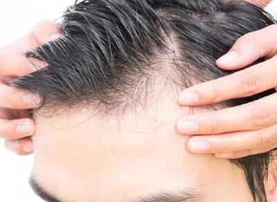  معجزه گیاه چینی: ریزش مو به تاریخ پیوست! - اکونیوز