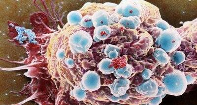  چیزهایی که در مرود سرطان نمی‌دانیم