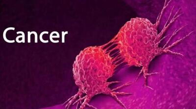  ۳۰ تا ۵۰ درصد سرطان‌ها قابل پیشگیری است / مردم به پیشگیری توجه کنند - مردم سالاری آنلاین