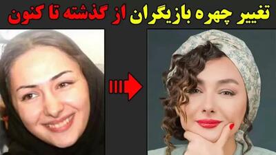  فیلم/ تغییر چهره 180 درجه ای  بازیگران زن مشهور بعد از عملهای زیبایی؛ سحر دولتشاهی، الناز حبیبی، نیوشا ضیغمی