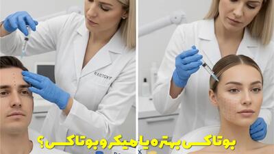  بوتاکس بهتره یا میکرو بوتاکس؟ بررسی هر دو روش به همراه مزایا و معایب