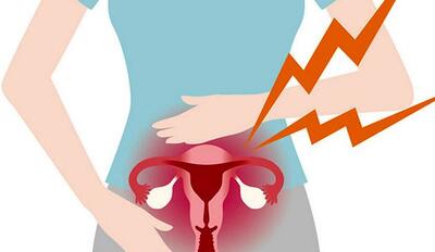  بعد از هیسترکتومی چه زمانی می‌توان رابطه جنسی داشت؟