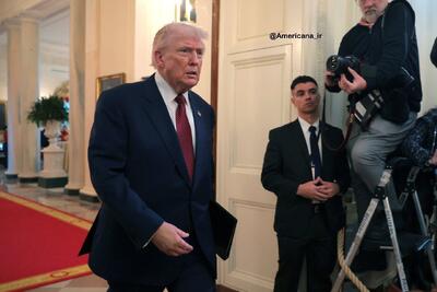  گریم کبودی پوست دست ترامپ