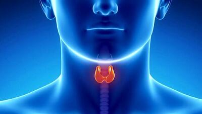  تیروئید شما را اذیت می کند این ۲۰ ماده غذایی مخصوص شماست