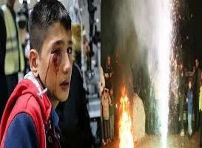  چهارشنبه‌سوری نیامده ۳ مصدوم گرفت