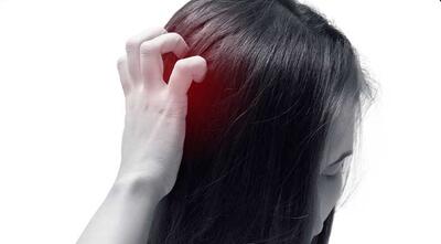  خارش سر و درمان آن