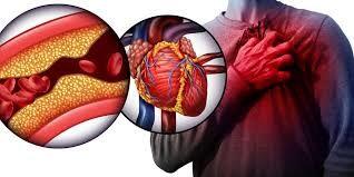  نشانه های روی ناخن که یعنی کلسترول خون شما بالا است