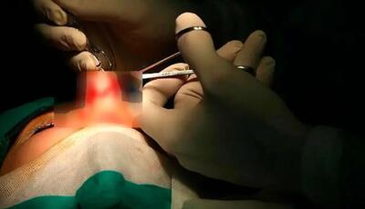  زن جوان هنگام عمل جراحی بینی جان باخت