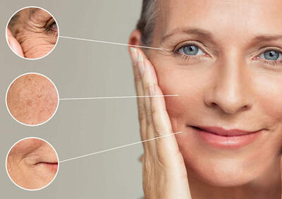  جوانسازی پوست با جیسل؛ نسل جدید جوانسازی بازساختی بدون درد و نقاهت - چی بپوشم