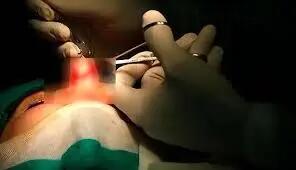  زن جوان هنگام عمل جراحی بینی جان باخت