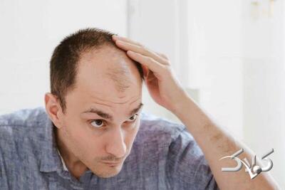  این گیاه چینی باعث رشد مجدد مو می شود - مجله اینترنتی کولاک