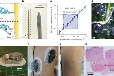  ساخت چسب حسگر هوشمند که بدن بیمار را رصد می‌کند